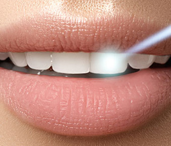 Edward J. Sharkey, DMD | Implant Dentistry, Implant Restorations and Root Canals