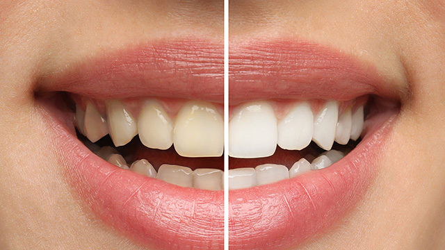 Edward J. Sharkey, DMD | Emergency Treatment, Digital Impressions and E4D