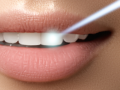 Edward J. Sharkey, DMD | Oral Exams, Sedation Dentistry and Root Canals