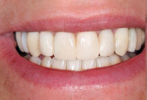 Edward J. Sharkey, DMD | Periodontal Treatment, Cosmetic Dentistry and Oral Exams