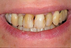 Edward J. Sharkey, DMD | Implant Restorations, Teeth Whitening and E4D